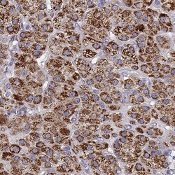 CYP11B2 Antibody, Novus Biologicals 25ul | Buy Online | Novus Biologicals | Fisher Scientific